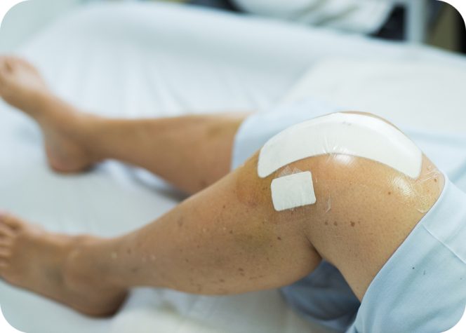 The future of joint replacement: innovations in hip and knee implants