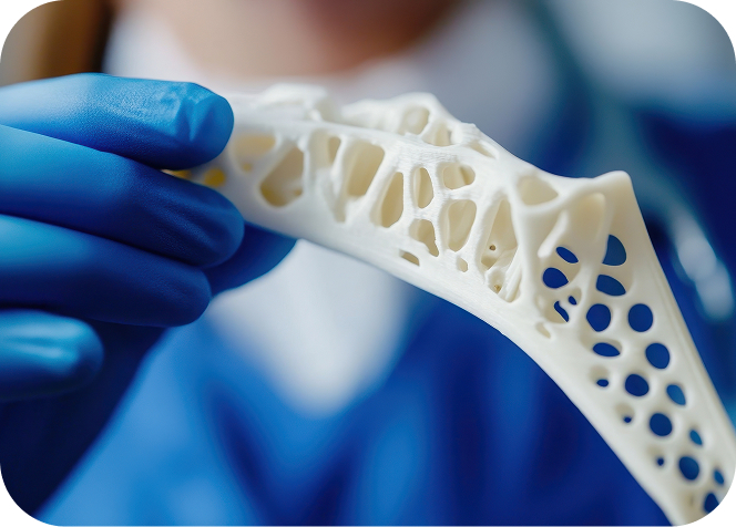 The role of 3D printing in personalised orthopaedic solutions