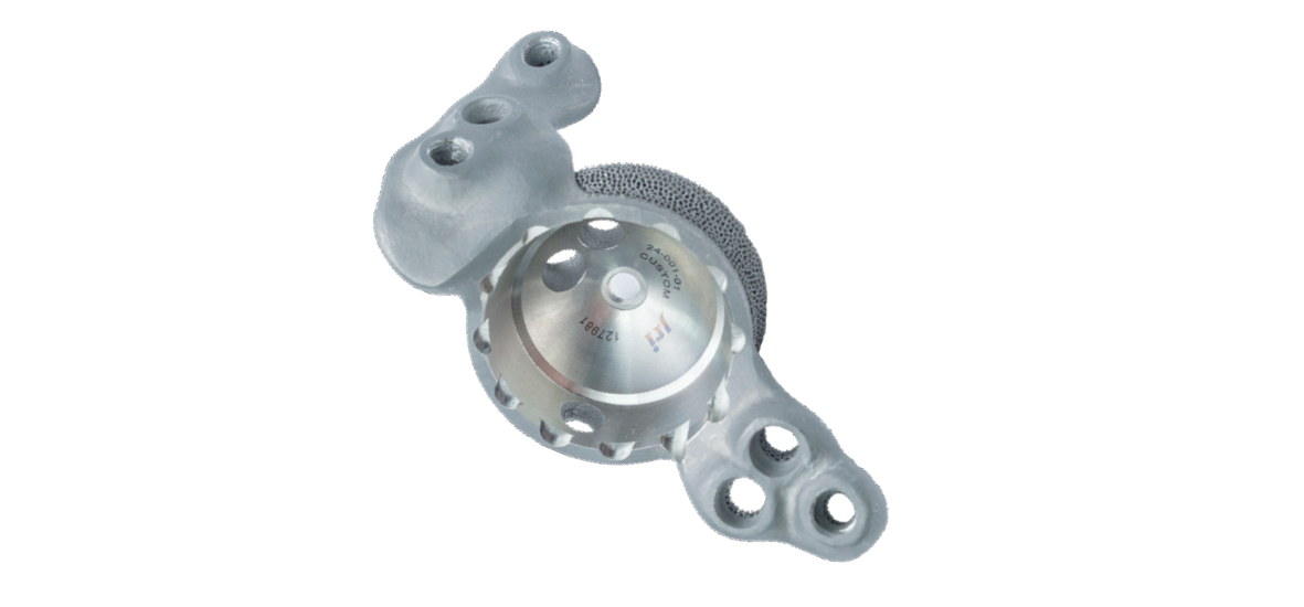 3D Printed acetabular cup